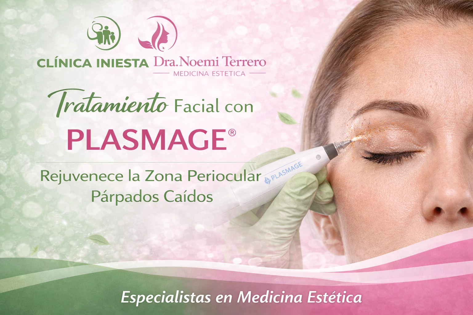 LASER PLASMAGE